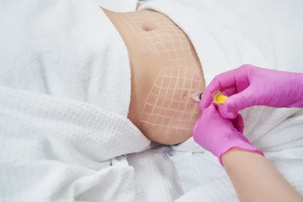 image of fat dissolving injections on love handles to help combat weight gain Dorchester