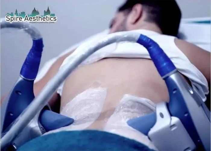 Man having fat freezing treatment done on love handles before a competitions Dorchester to create a sculpted look.