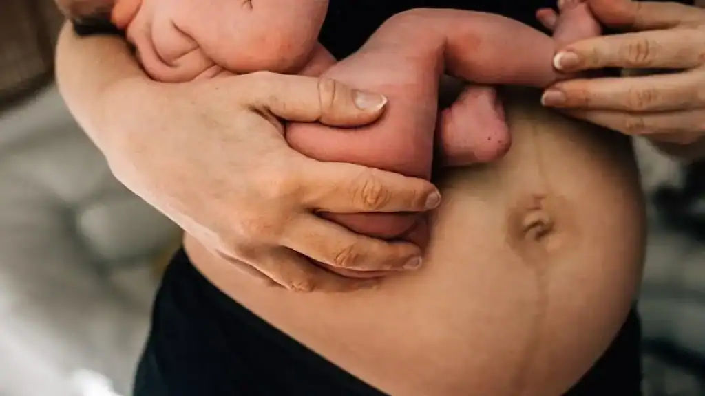 Why Is My Stomach Still Big After Pregnancy Dorchester?